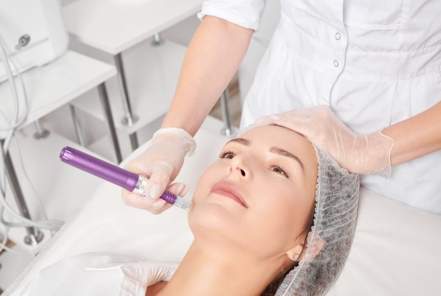 Μεσοθεραπεία – Microneedling